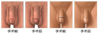 ��Ƥ������Ч��ͼ