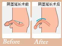 �����ӳ���Ч��