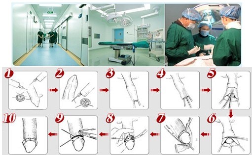 ��Ƥ�����ֲ�����΢����